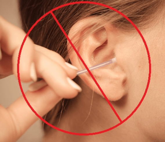 Cotton buds ear wax removal