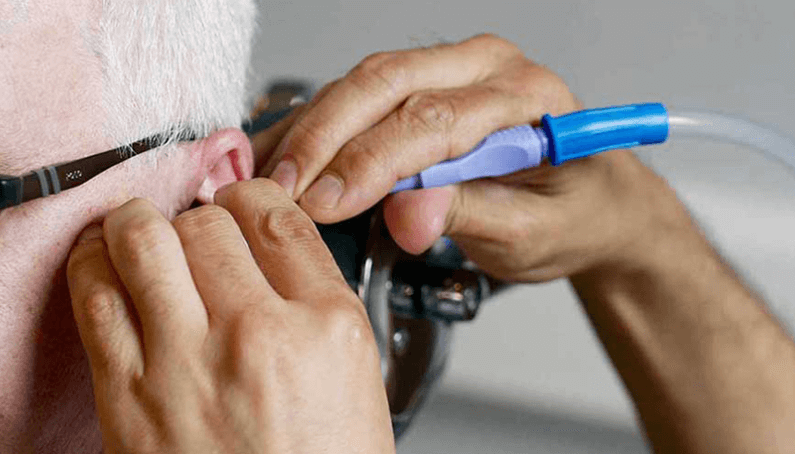 Microsuction Ear Wax Removal